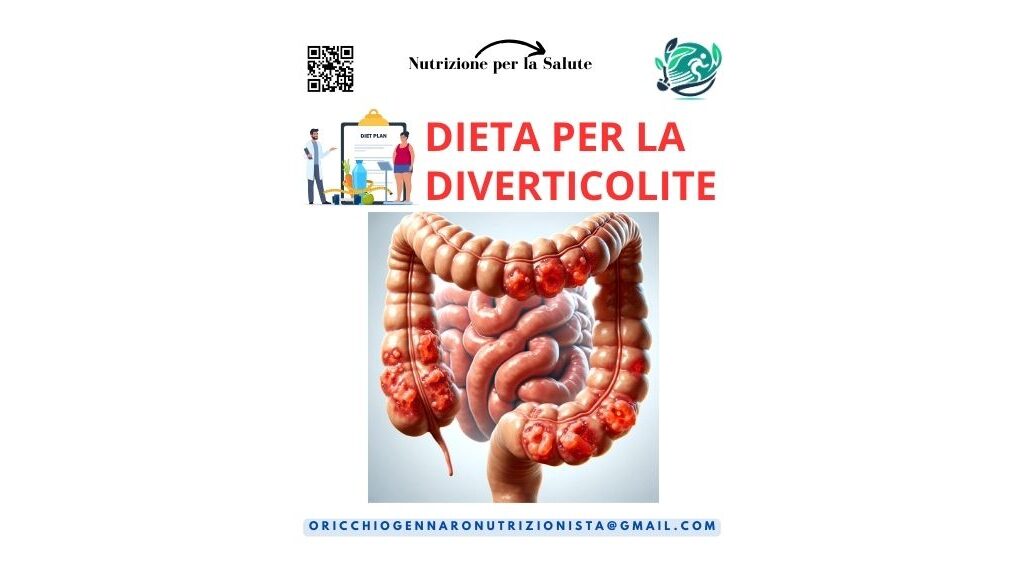 DIETA PER LA DIVERTICOLITE